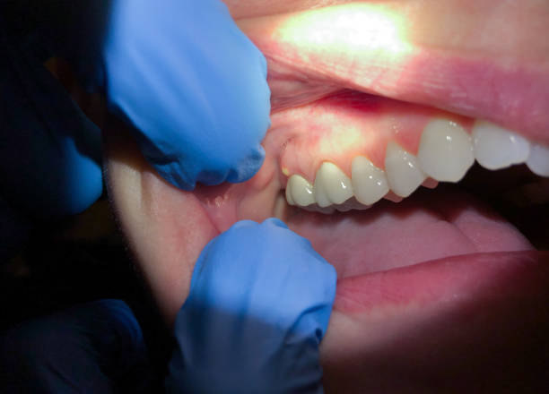 Best Tooth Infection Emergency Dentist  in Central Islip, NY